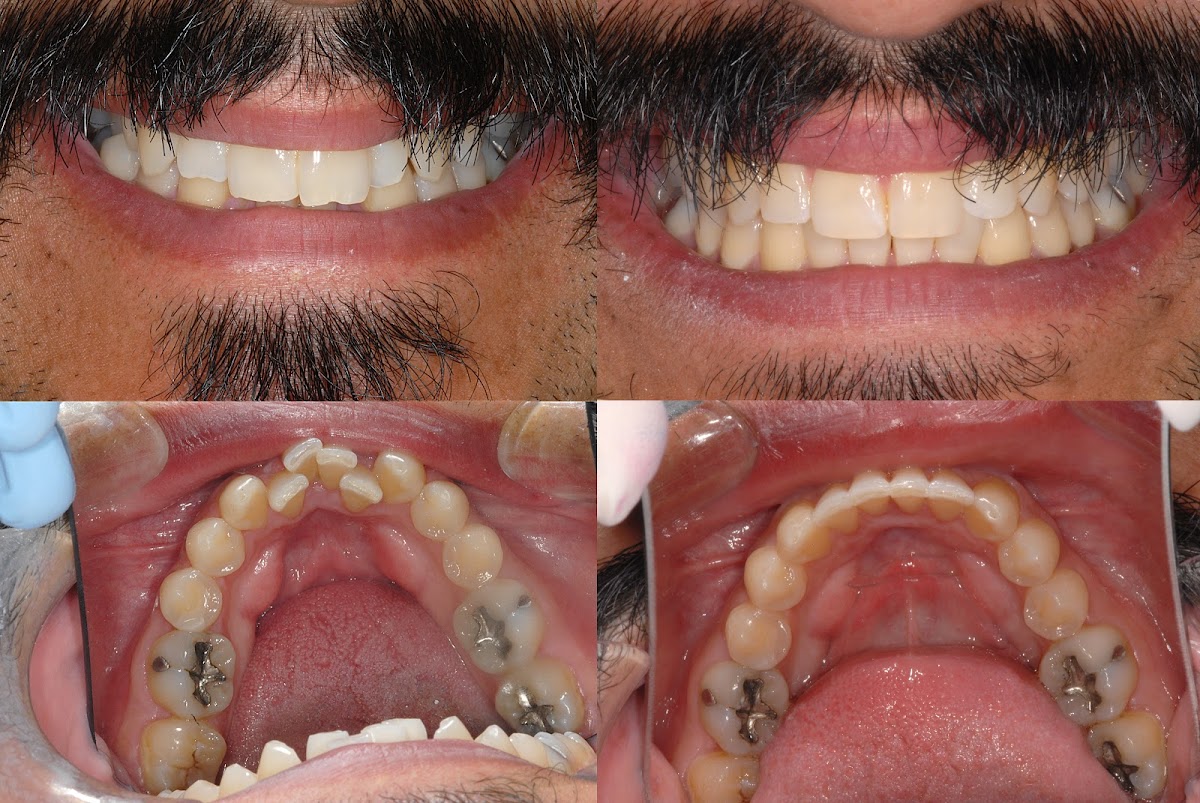 Pure Dentistry Rocklin photo 3