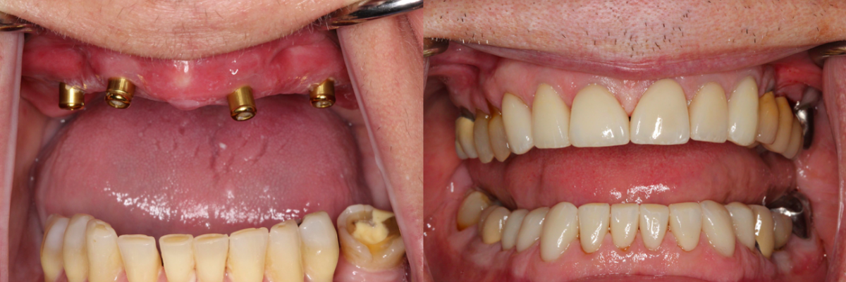 Cosmetic and Implant Dentistry of Connecticut photo 4