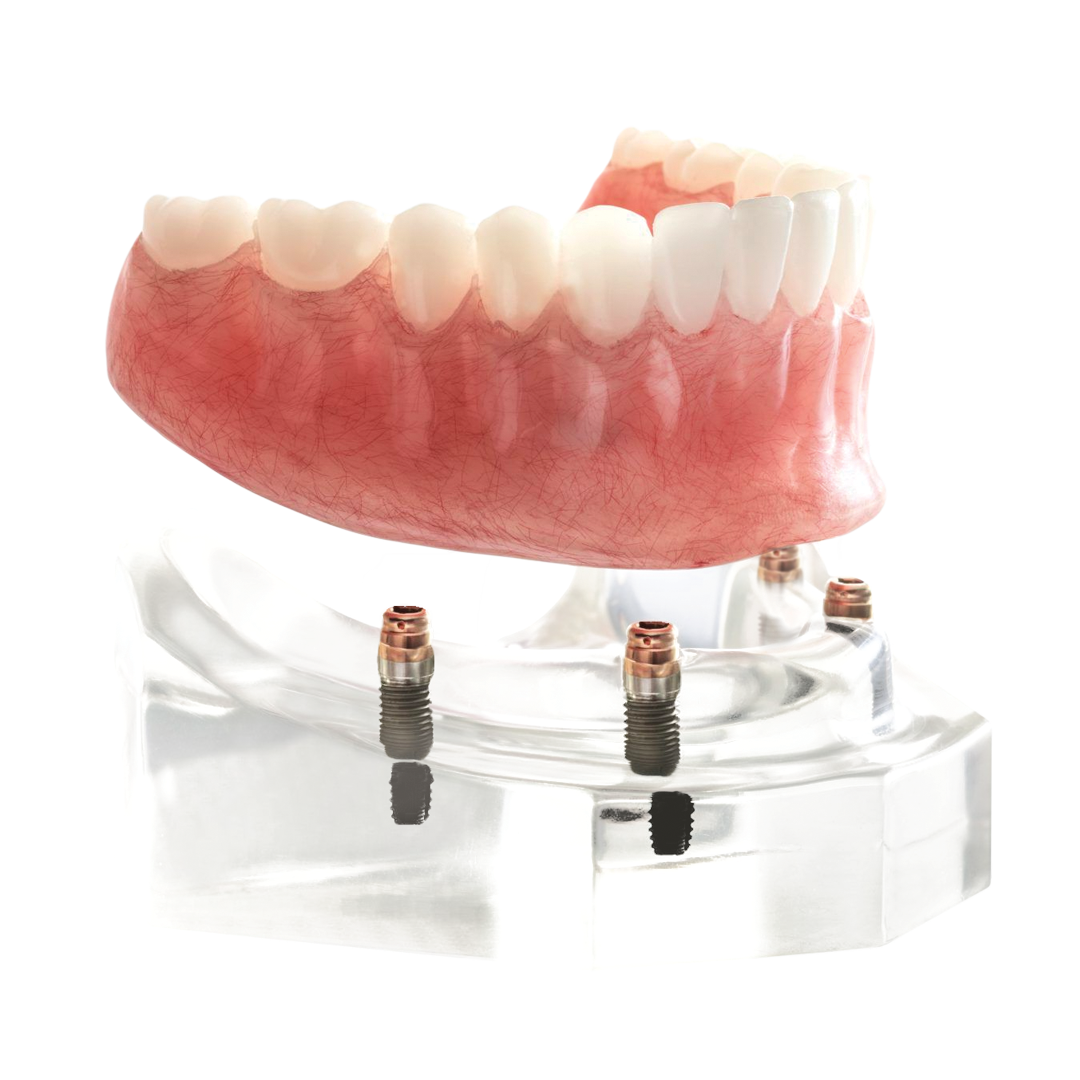 Affordable Dentures & Implants - Manor photo 3