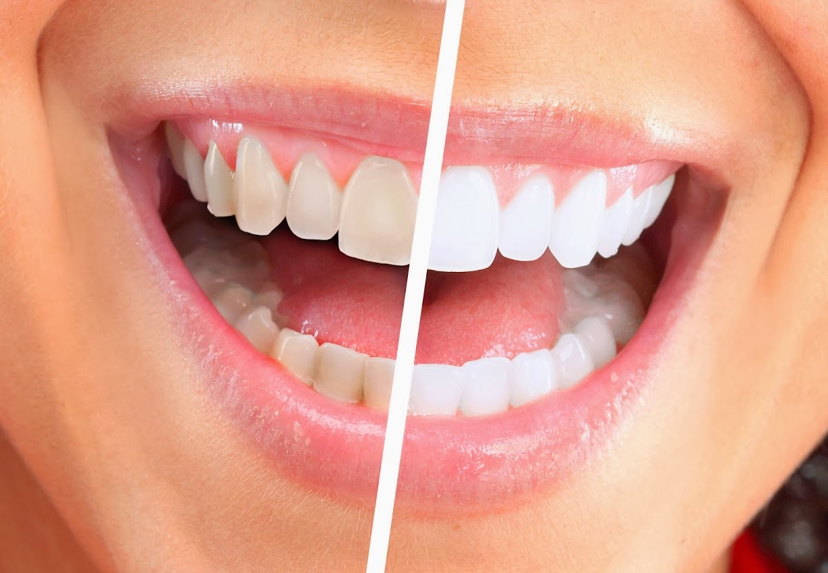 Milner Dentistry photo 5