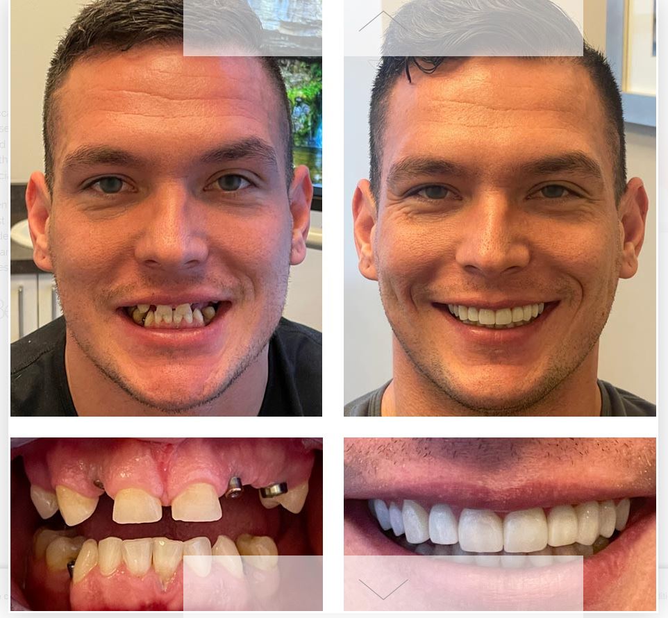 Sf Dental Implants Center photo 5