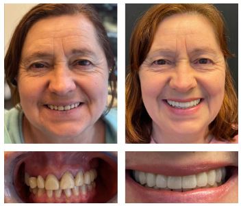 Sf Dental Implants Center photo 6