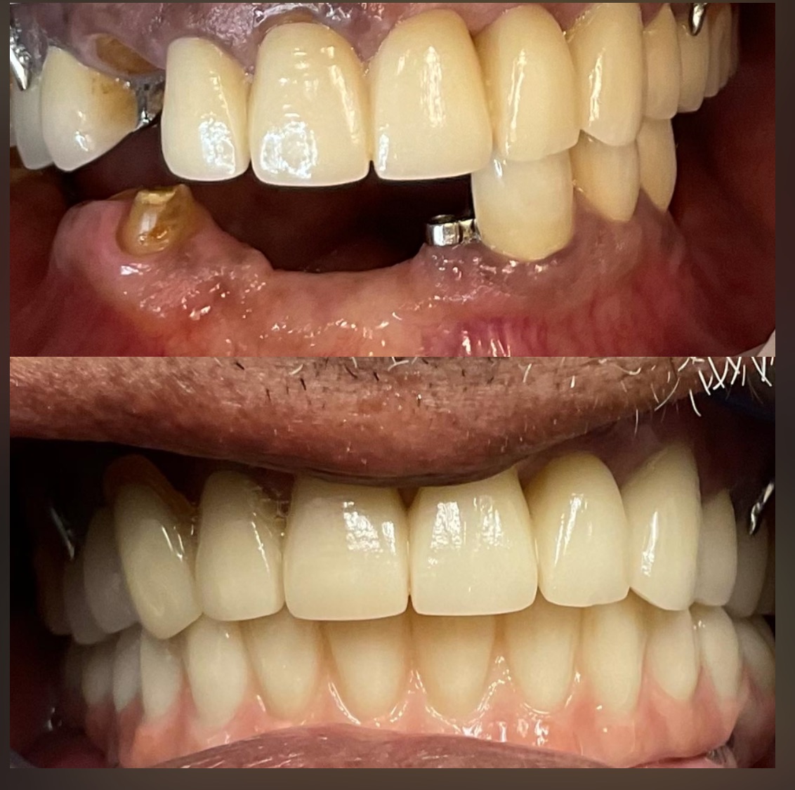 Plume Dental Implant Studio photo 2