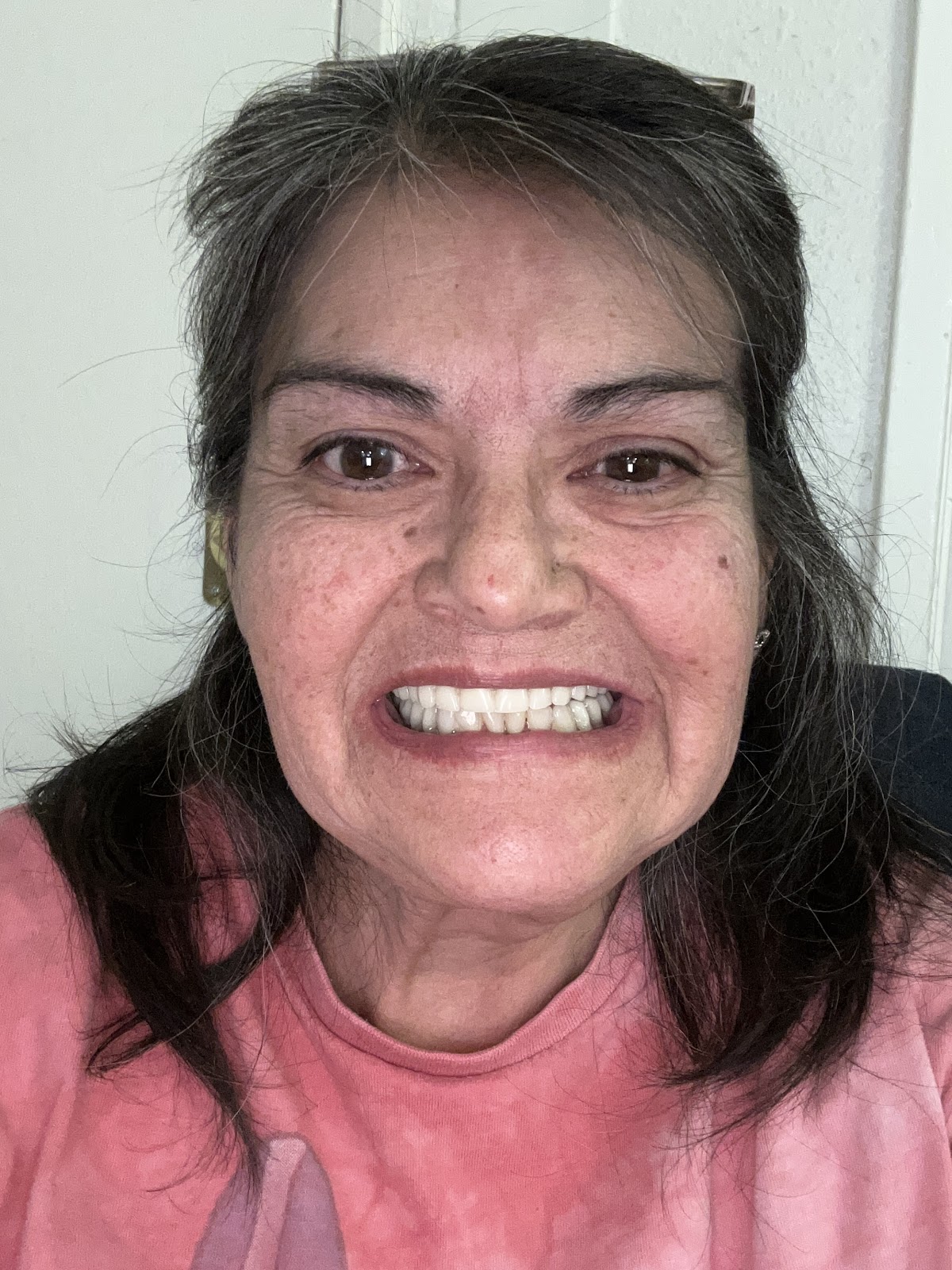 Plume Dental Implant Studio photo 5