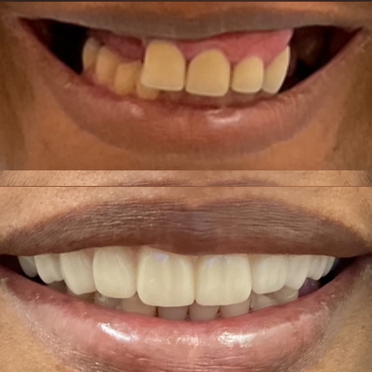 Plume Dental Implant Studio photo 6