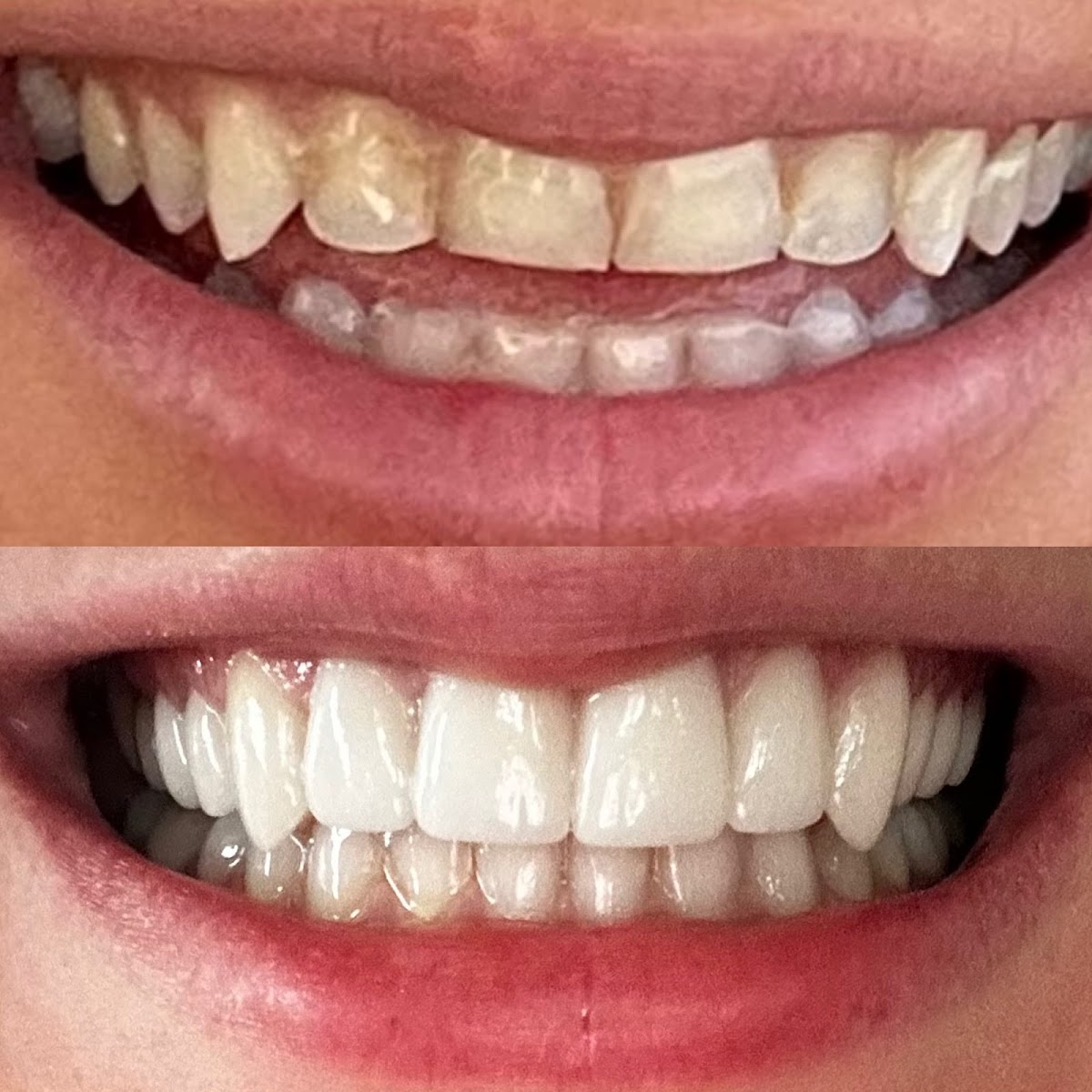 Gentle Dental Nashua photo 4