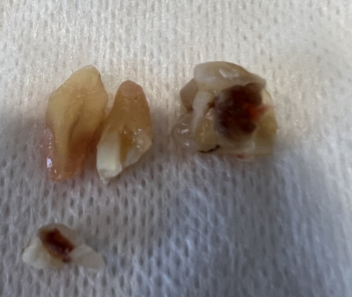 Upstate Oral and Maxillofacial Surgery photo 6