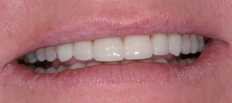 Brian Allen DDS photo 4