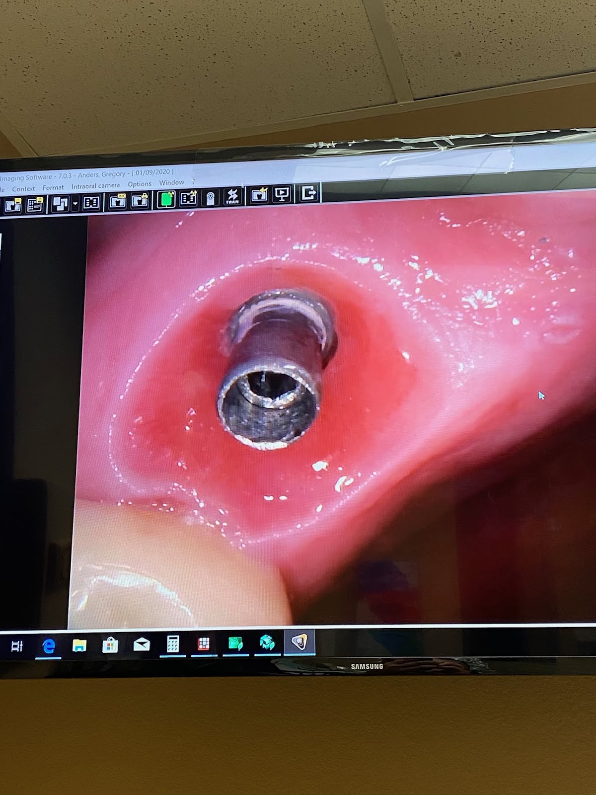 Doc'S Dental Implants And Crowns - Irving photo 6