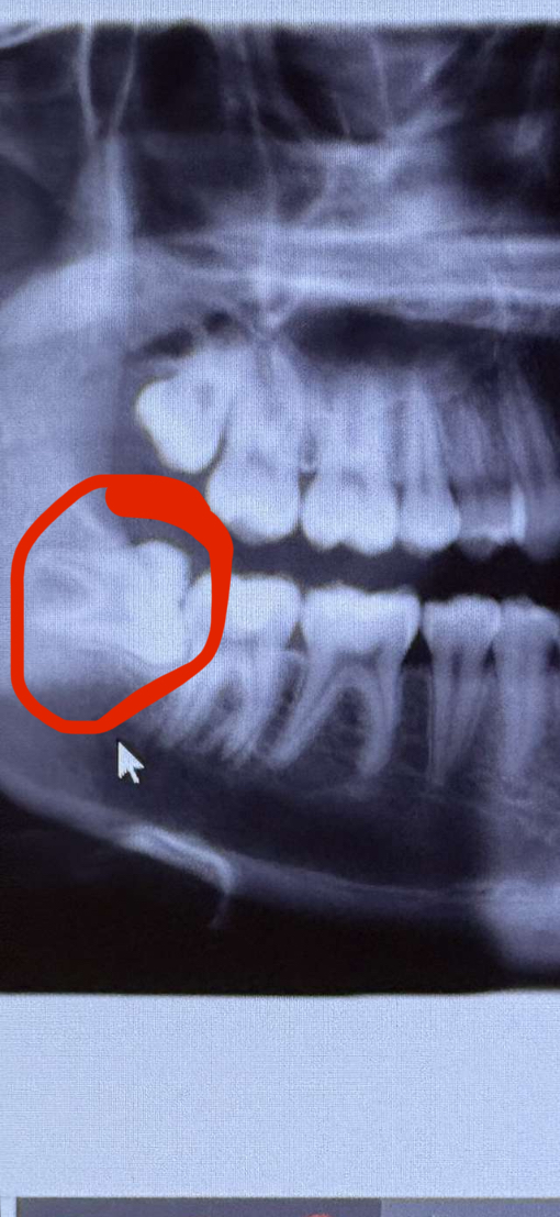 Dental Oral Surgery photo 5