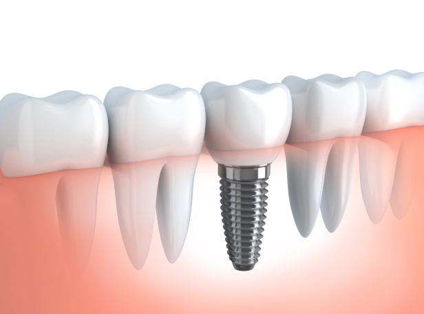 Riverview Family Dental photo 4