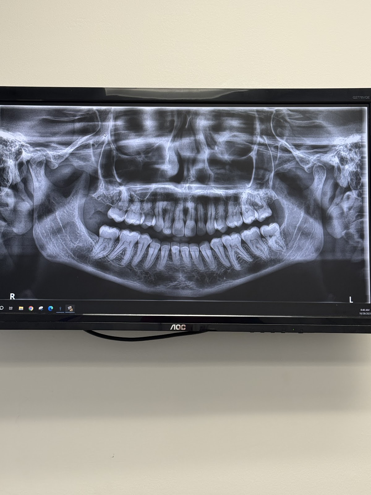 South Florida Institute of Oral Surgery (sfios) - Pompano Beach photo 5