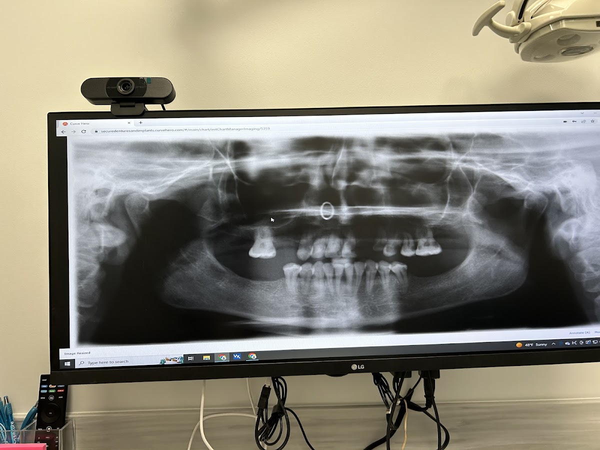 Secure Dentures & Implants photo 3