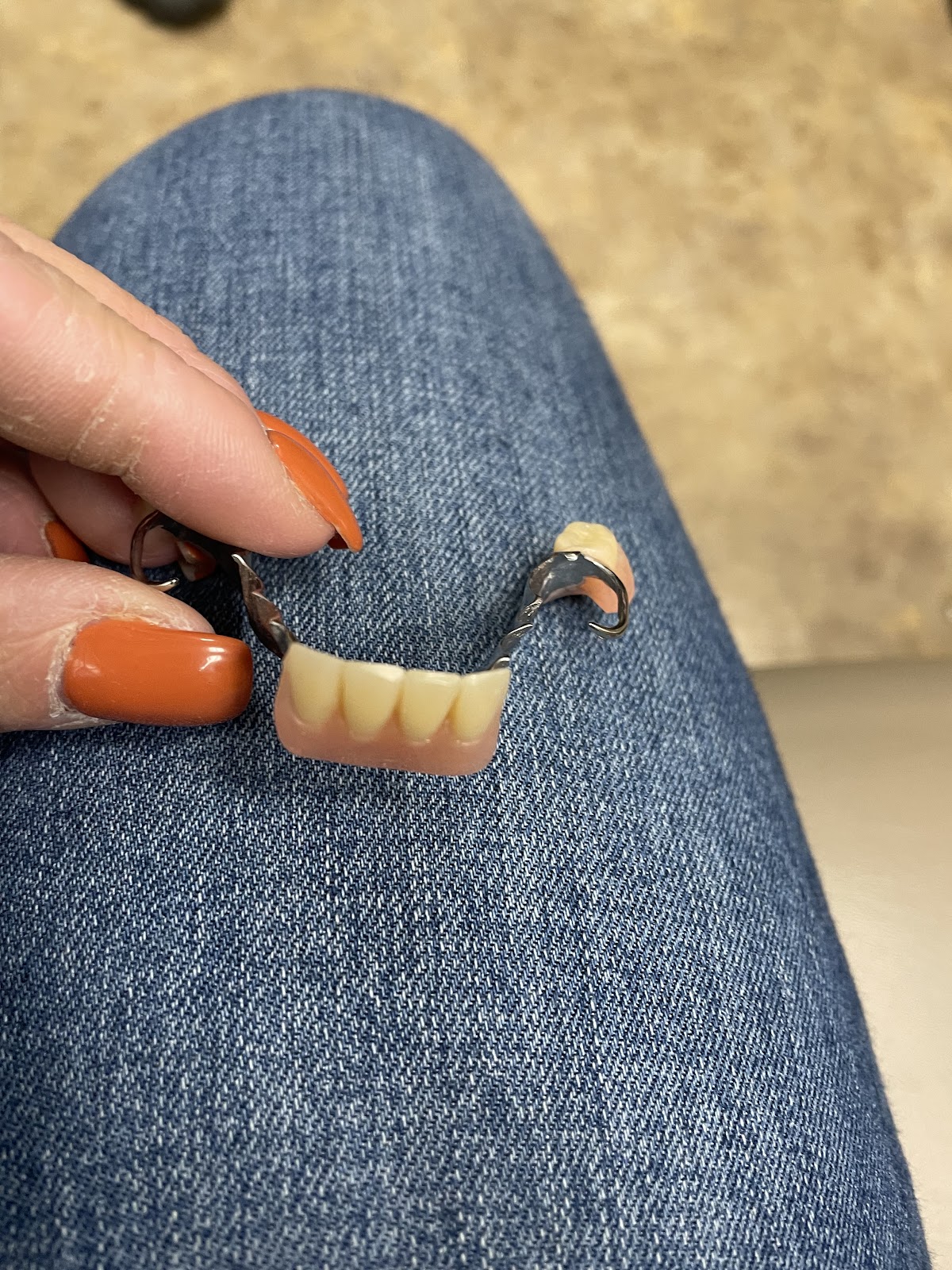 Aspen Dental - Mohegan Lake photo 2