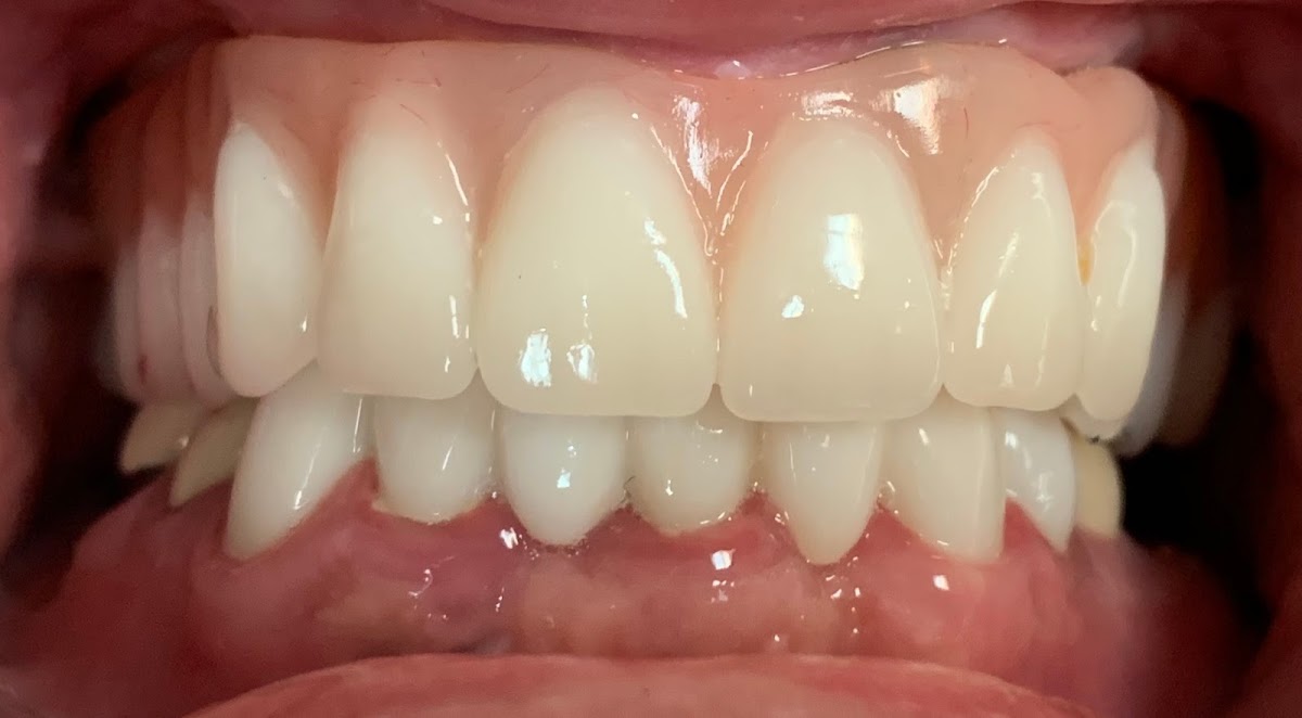 Dentist St. George | Smiles Restored photo 3