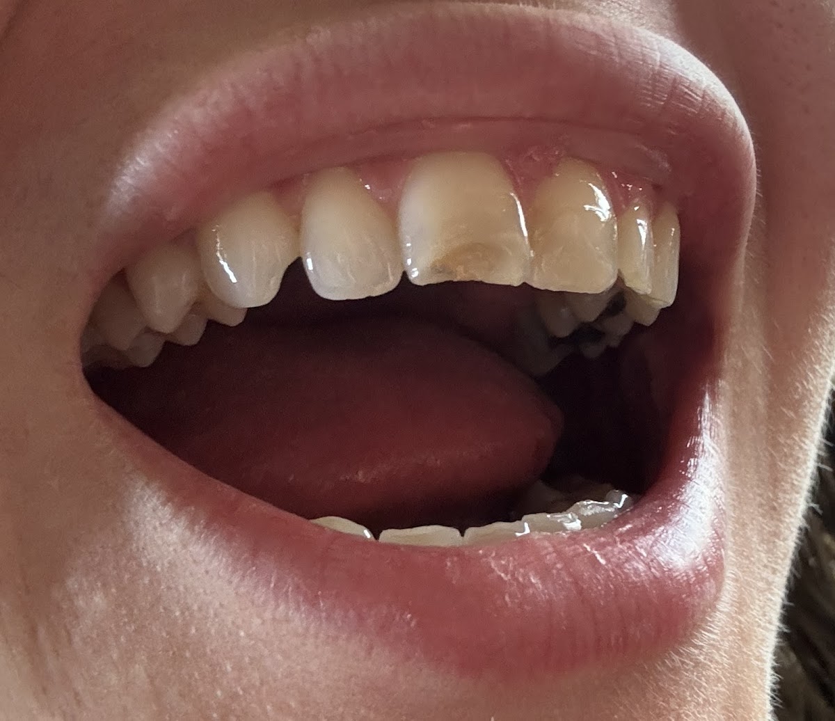 Emergency Dental Care Usa photo 5