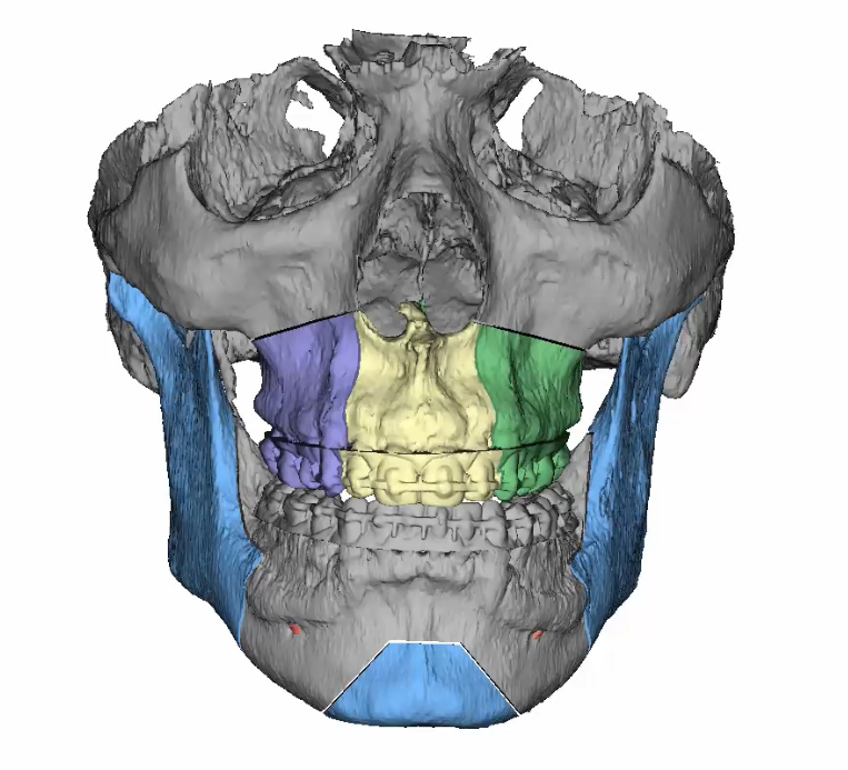 The Center for Oral and Maxillofacial Surgery - Dr. Henry H. Rowshan photo 2