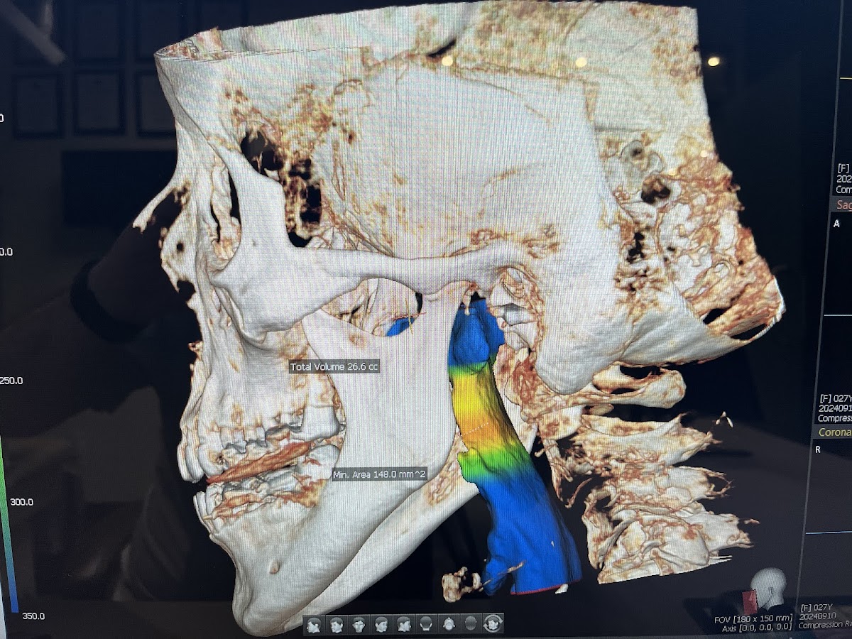 The Center for Oral and Maxillofacial Surgery - Dr. Henry H. Rowshan photo 6