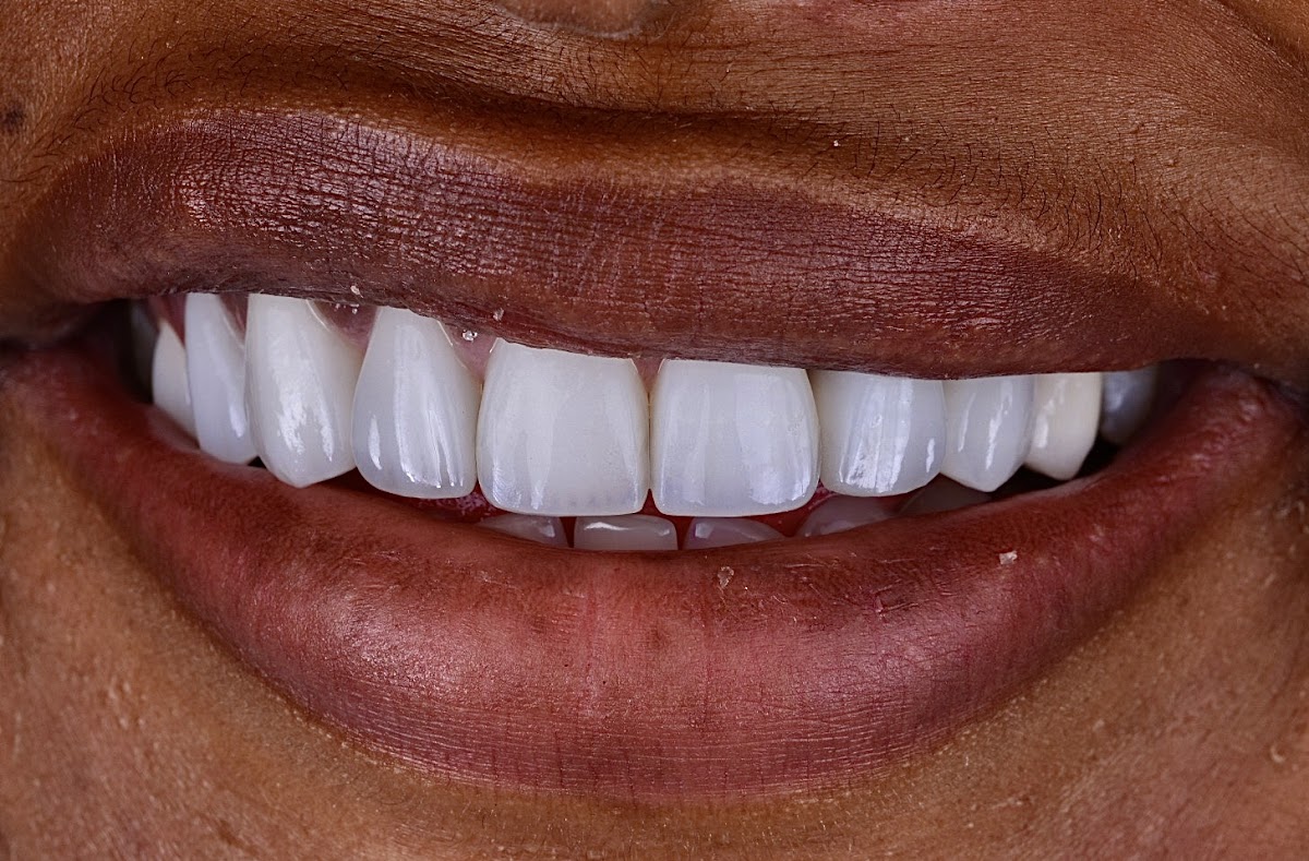 Newhall Dental Arts photo 6