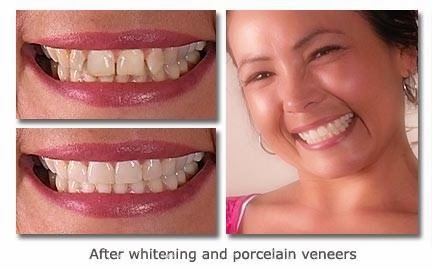 Cary Implant and General Dentistry photo 6