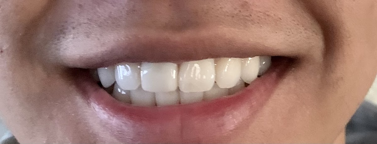 Ultimate Dental Elk Grove photo 5
