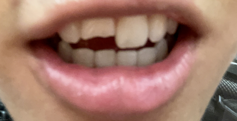 Ultimate Dental Elk Grove photo 6