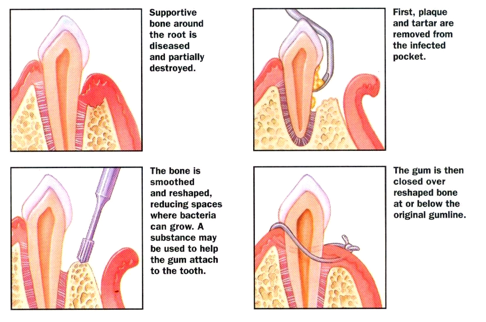 Cary Periodontics and Implant Dentistry photo 3