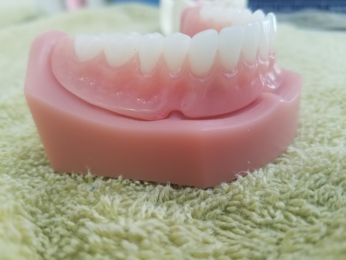 Dentures Direct photo 2