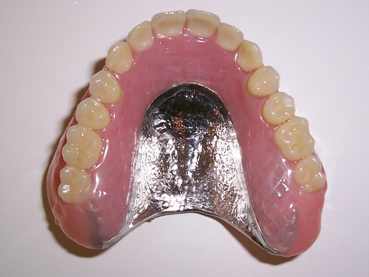 Dentures Direct photo 4