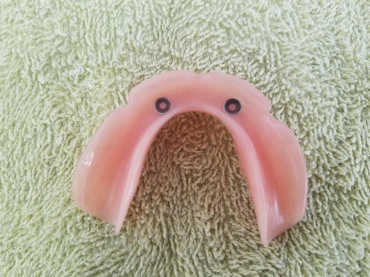 Dentures Direct photo 6
