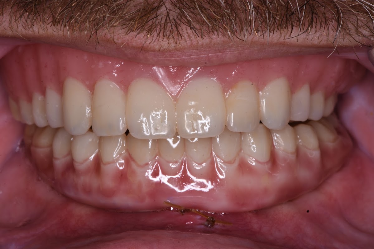 Ctx Oral Surgery & Dental Implants (temple) photo 3