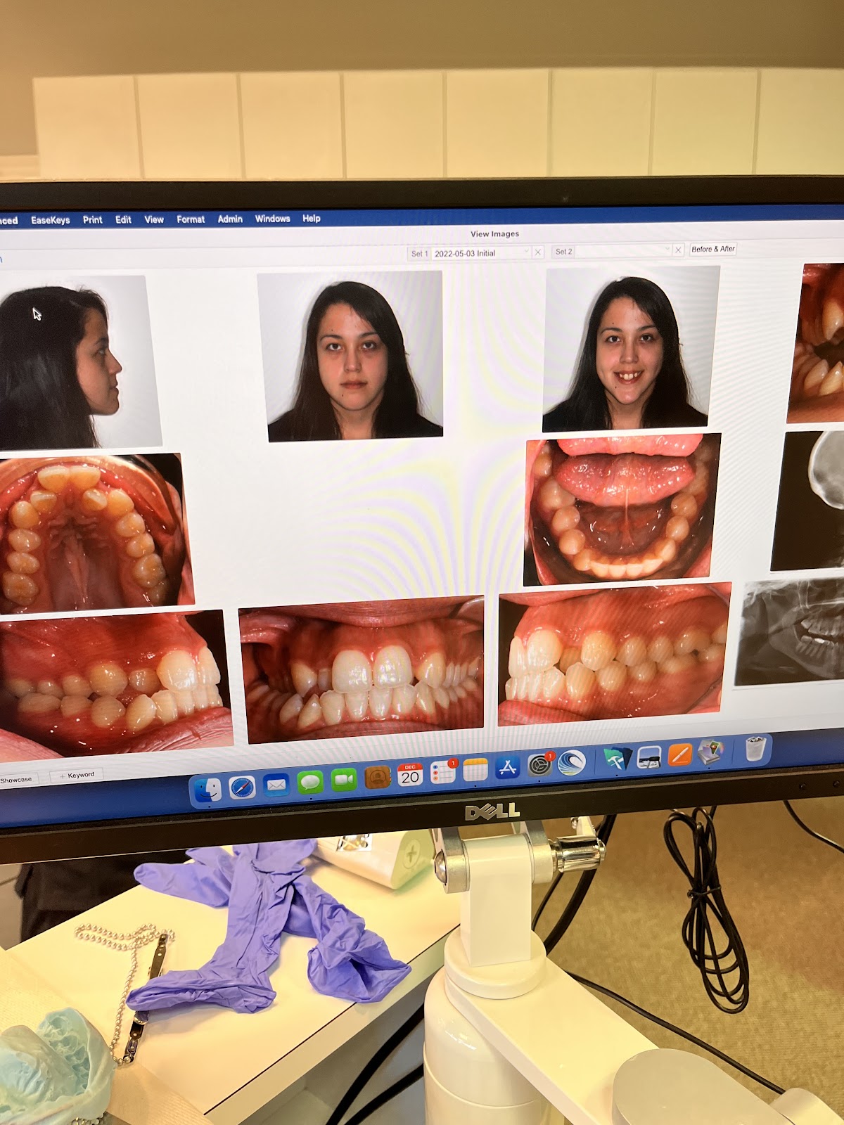 Texas Oral and Maxillofacial Surgery photo 5