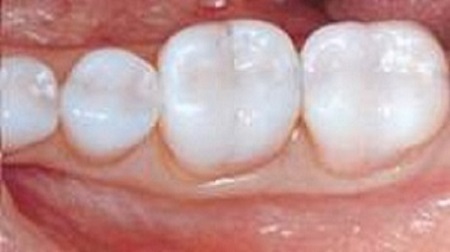 Advanced Dental Concepts photo 5
