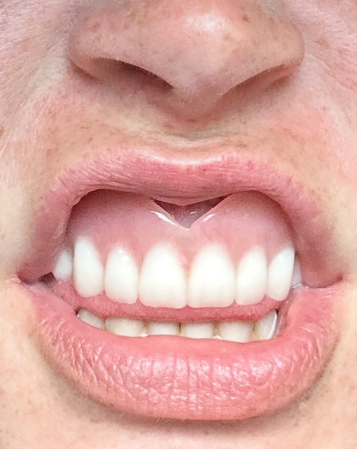 Affordable Dentures & Implants - Morristown photo 3