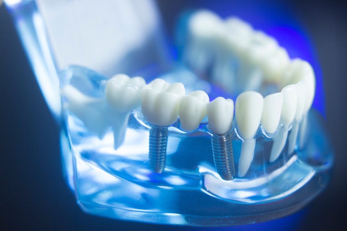 Dental Designers of Rockford photo 3