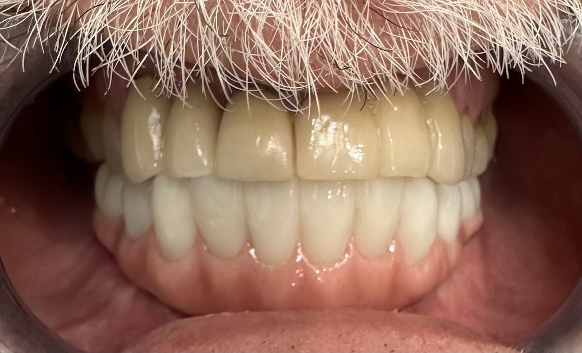 Pearl Dentistry & Implants photo 3