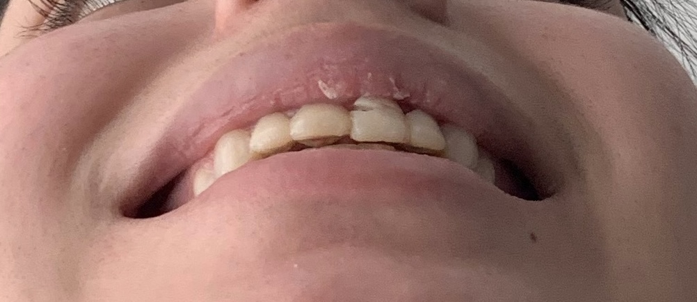 Dental & Implant Centers of Colorado - Westminster photo 3